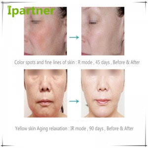 ขายร้อน LED โฟตอนการรักษาด้วยอุปกรณ์ความงามสำหรับการดูแลผิว