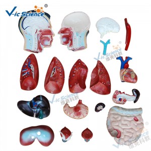 กายวิภาคศาสตร์แพทย์มนุษย์ร่างกายรุ่น 85 เซนติเมตรลำตัวชายรุ่น 19 ชิ้นส่วน