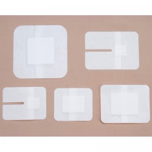 รวมทั้งการตกแต่งแผลกาว