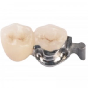 สิ่งที่แนบมาอย่างแม่นยำ